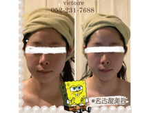 ★お電話での、ご予約が増えました♪感謝です★