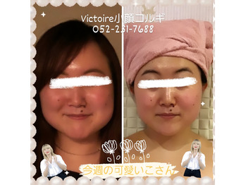 ●整形する前に、まずvictoireに来てください●