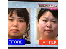 ●小顔になるために必要な事を、しっていますか？●